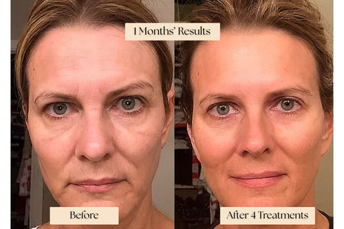 Serum Infusion Skincare