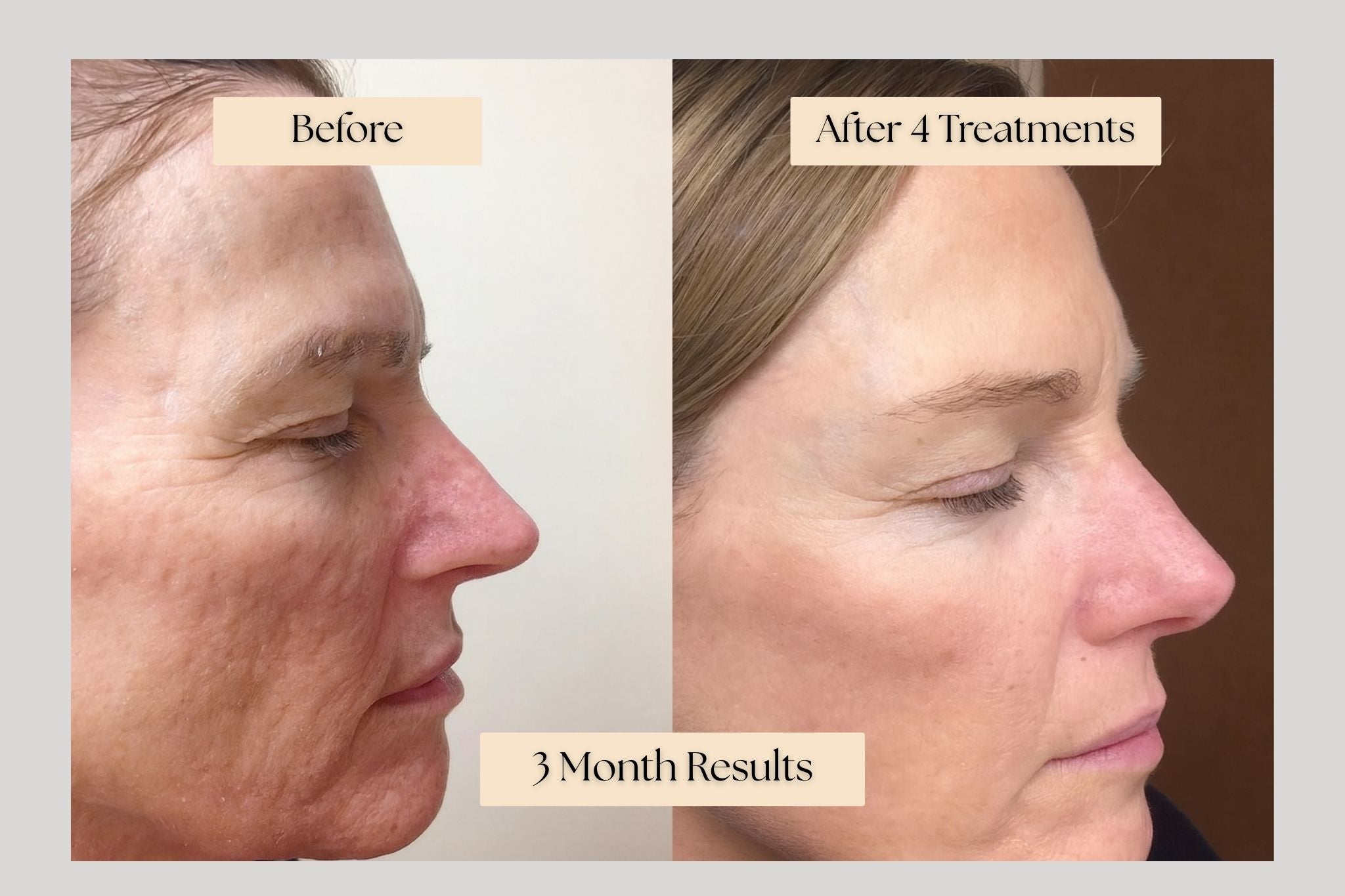 Rejuvenating Infusion Therapy System