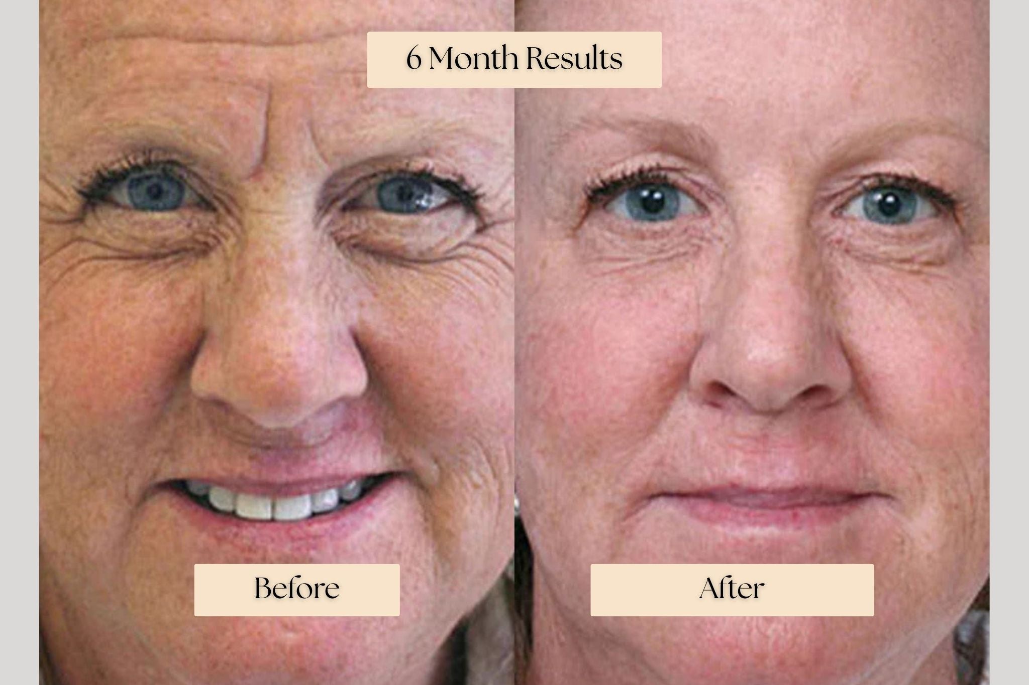 Rejuvenating Infusion Therapy System