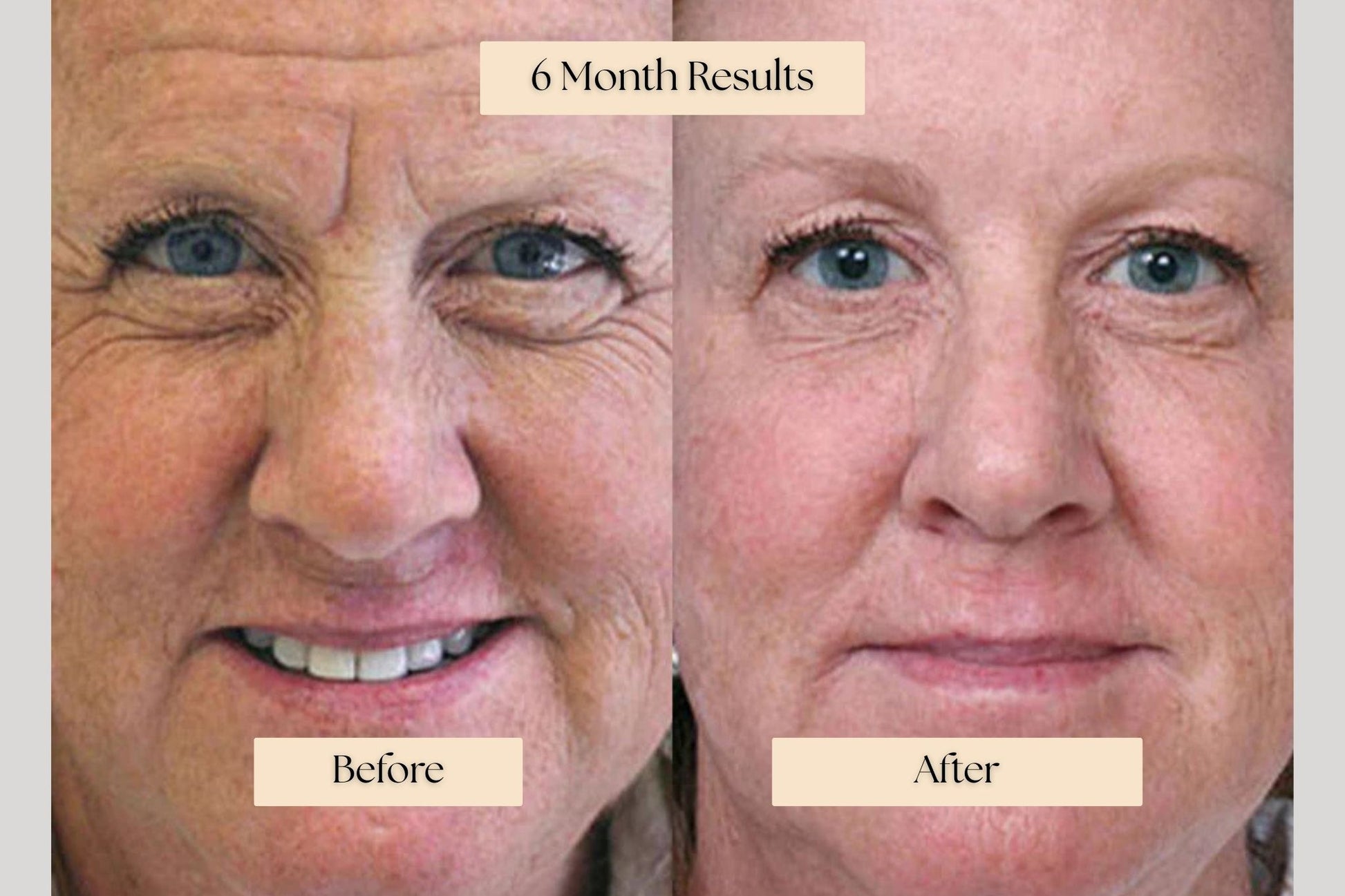 Serum Infusion Skincare