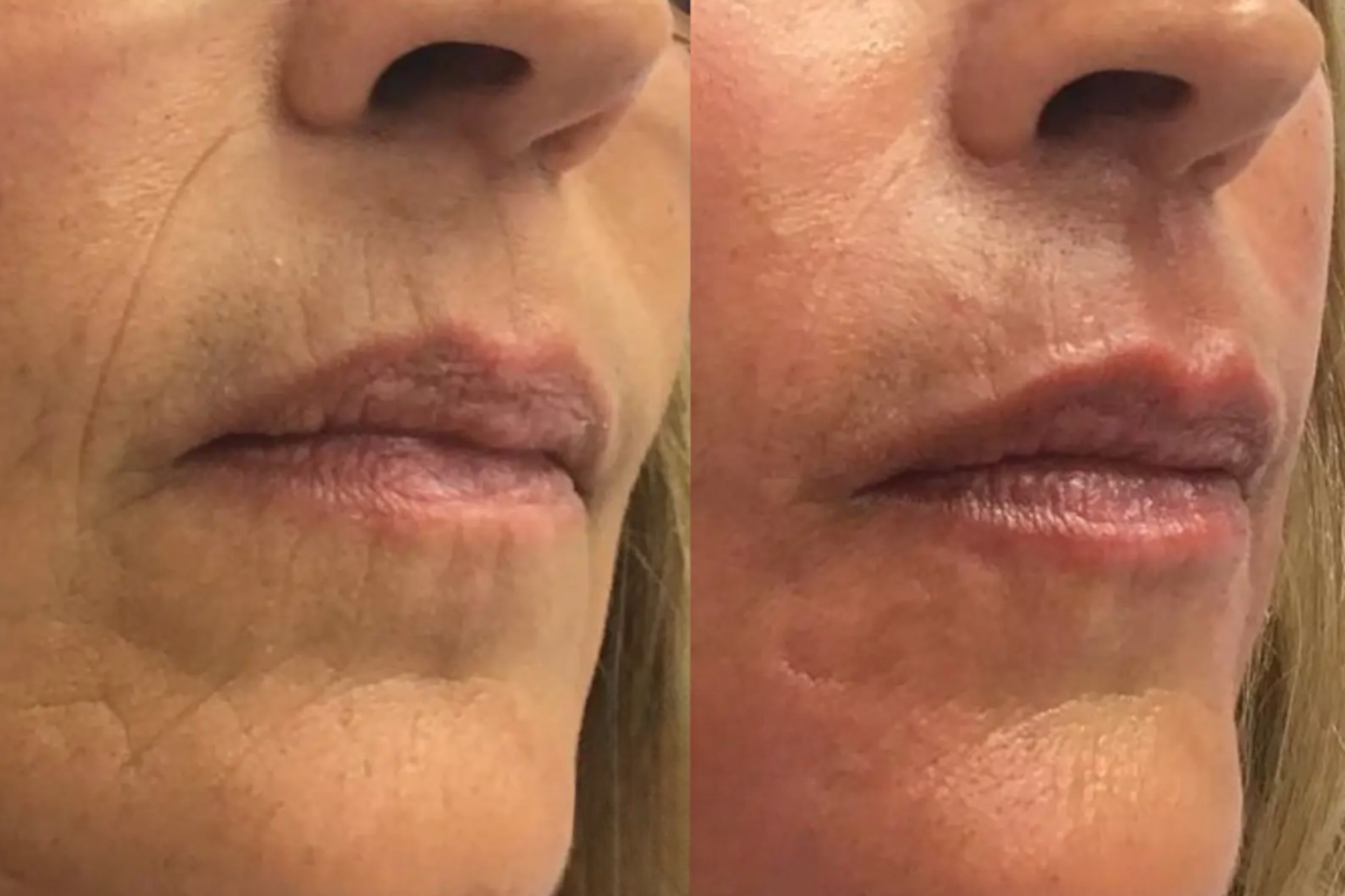 Rejuvenating Infusion Therapy System